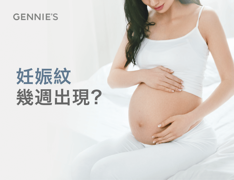 妊娠紋幾週出現-孕婦保養推薦