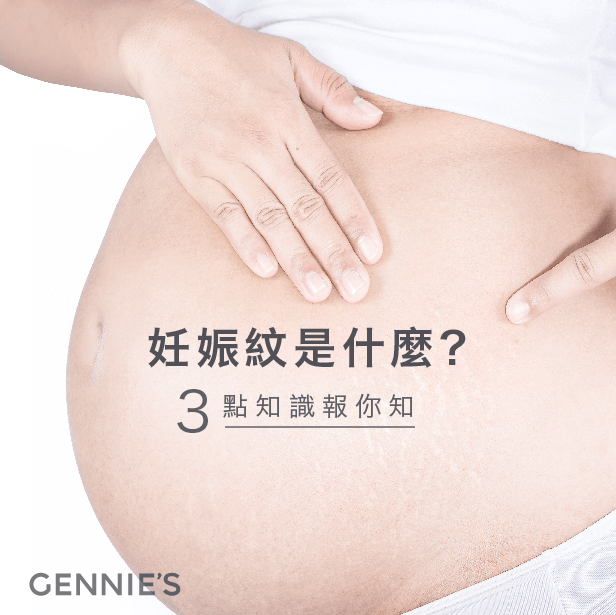 妊娠紋什麼時候長-妊娠紋是什麼